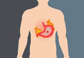 Stomach cancer, or gastric cancer, is a fairly uncommon type of cancer. Gastritis Could It Be The Cause Of Your Bad Bellyache Health Essentials From Cleveland Clinic