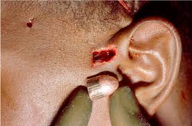 Check spelling or type a new query. Pathology Outlines Gunshot Wounds