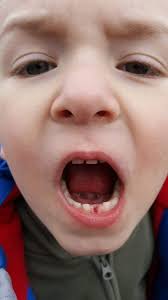 Vicki Keys (@vixbrock)