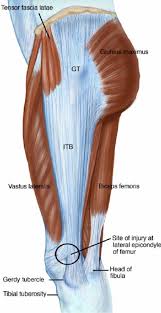 Smooth opinion above and behind the lateral epicondyle there is an origin to the lateral head of. The Iliotibial Band And Site Of Injury At Lateral Epicondyle Of The Femur Download Scientific Diagram
