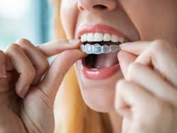 El Significado Oculto De Sonar Que Te Quitas Los Dientes Actitudfem