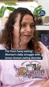 Faye Bingham, 28, from Stourport-on-Severn, is living with ARFID or  Avoidant Restrictive Food Intake Disorder and says it’s “not a choice” and  without her feeding tube she wouldn’t be alive. An NHS ...
