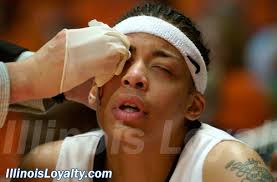 Illinois Knocks Off Minnesota