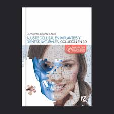 Blog de Rehabilitación Oral Dr. Pedro Luis Pérez Castro desde Córdoba