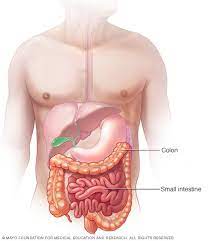 Lactose Intolerance Symptoms And Causes Mayo Clinic