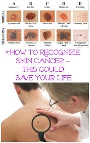 Telemedicine is a growing field, and skin care is not a few factors increase your risk of skin cancer, and if you have any of these, you. Pin On Skin
