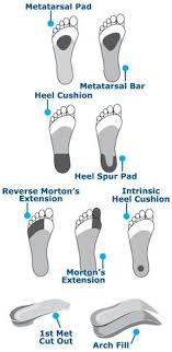 When massage, exercise, and other remedies fail, surgery is an effective option. 55 Orthotics Ideas Orthotics Feet Care Foot Health