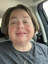 It's in. One turn down, many to go. ( photo in B&W makes it less disturbing  to me) 37 year old female Starting IMW: 33mm Reasons: upper airway health  (narrow and deviated