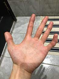 Maybe you tried to put on a pair of gloves that were too small and once you took them off, you couldn't straighten your finger all the way. My Pinky Is Somewhat Crooked Mildlyinteresting
