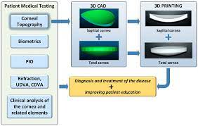 Symmetry Free Full Text 3d Printed Personalized Corneal Models As A Tool For Improving Patient S Knowledge Of An Asymmetric Disease Html