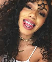 Black And Purple Braces Color Attention Like What You See Follow Me For More Pin Bvbygirlmaya Cute Braces Brace Face Braces And Glasses