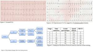 Figure Stress Testing Ecg And Charts Contributed By