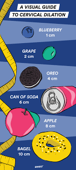 Medication with prostaglandins (either oral or vaginal) to encourage cervical softening and dilation. Cervical Dilation What To Expect And How To Speed Things Up