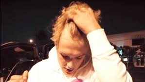 Hair surgeon reacts to @ksi's hairline! Is Jake Paul Balding Evidence Of His And Logan S Hair Loss