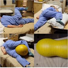 Image result for Manual Rotation in Occipitoposterior Presentation
