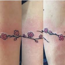 Which is the best laser for tattoo removal? I Removed My Tattoo By Excision Vancouver Bc Review Realself