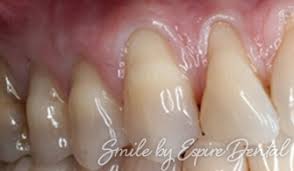 Freedentalcare.us is a free website maintained by users like you. Premier Dental Implants Surgery Espire Dental Oklahoma
