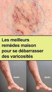 Pin On Sante
