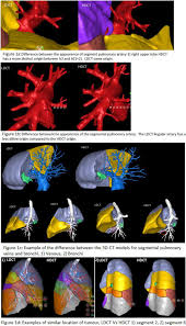 SCTS Annual Meeting 2024: Abstracts | Journal of Cardiothoracic Surgery |  Full Text