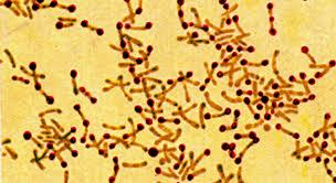 From the nature of the membrane. Diphtherie