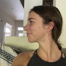 WALTER W SCHROEDER, MD