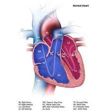 4 5 Transposition Of Great Arteries Q20 3 Cdc