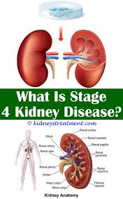 Kidney Stones Kids Kidney Disease Recipes Kidney Disease Kidney Failure