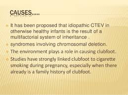 Clubfoot is a congenital foot deformity in which the foot turns down and inward. Club Foot