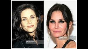 The number of people getting cosmetic procedures has risen steadily over the past five years and there are several reasons why. Courtney Cox Plastic Surgery Before And After Photos Youtube