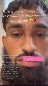 Bryant Myers Reveals His Face After Controversy