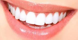 vesta corlu adli kullanicinin diyarbakir panosundaki pin dogal dis beyazlatma dis dogal gorunum