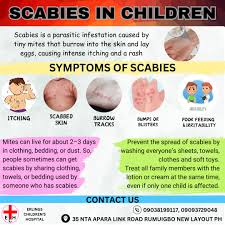 Image result for scabies human children
