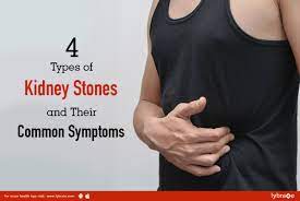 4 Types of Kidney Stones and Their Common Symptoms - By Dr. L.K. Jha |  Lybrate
