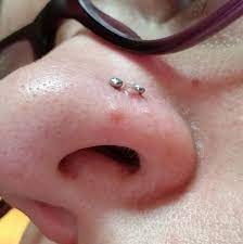 Tips For Getting Rid Of This Bump On My Piercing Piercing