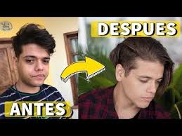 Trucos Para Adelgazar La Cara Y Eliminar Cachetes Rapido Youtube Como Adelgazar La Cara Como Adelgazar El Abdomen Adelgazar Cara La ginecomastia puede desaparecer por sí sola. adelgazar la cara y eliminar cachetes
