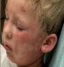 The results of kids lighting fires in the Orchard, it's no small campfire  size bit, it's way bigger. You're bound to know from the descriptions given 