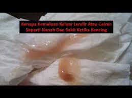 Merah warna merah pada keputihan di luar siklus menstruasi dapat mengindikasikan infeksi serviks, polip (tumor jinak) pada serviks, dan kanker serviks. Kenapa Kemaluan Keluar Lendir Atau Cairan Seperti Nanah Dan Bahaya Nya Youtube
