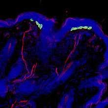 Just over 1,500 people were diagnosed with mcc in england between 1999 and 2008. Merkel Cells Give You A Light Touch National Institutes Of Health Nih