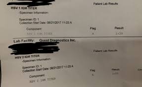 When a serum antibody test is recommended for hsv, igg detection is. Am I Positive For Hsv Genital Herpes Simplex Forums Patient