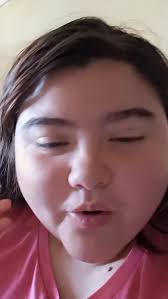 Solo pido compartir naya no pido colaboración económica y que todo el mundo  se ponga la mano en el corazón , #lukatonxnath #chile #viralvideos  #ehlersdanlossyndrome #chile