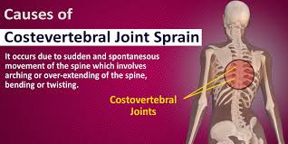 Causes Of Costovertebral Joint Sprain Deep Massage Sprain Joint