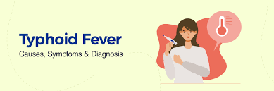 Image result for Typhoid Fever