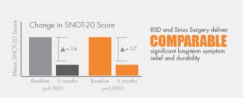 Image result for Sinusitis Prediction Rule