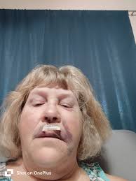 Well nothing broken, Praise God! Just brushed badly...