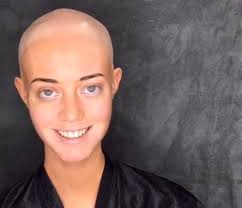 Model Takes Off Her Wig On Camera To Reveal Her Alopecia Diagnosis For The  First Time