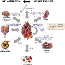 Inflammation Cause Or Consequence Of Heart Failure Or Both Springerlink