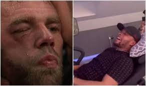 Say what you want about billy joe saunders but the man's cheek bone got. Sjb9jprqtdpuqm
