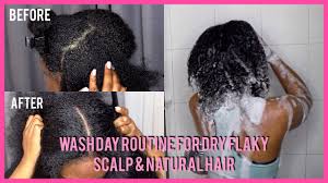 Shop for dry shampoo as you would any traditional shampoo — by your hair care needs or type. Wash Day Routine For Extreme Dry Flaky Scalp Natural Hair Youtube