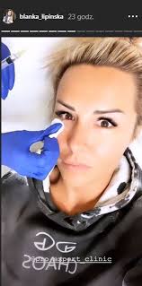 Blanka lipińska wstawiła nowe zdjęcie z baronem, a my patrzymy na jej twarz. Wow Ale Metamorfoza Blanka Lipinska Pokazala Stare Zdjecie Kozaczek
