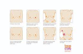 What are the different types of breast cancer? Breast Cancer Awareness Month 2015 Orchid Lingerie